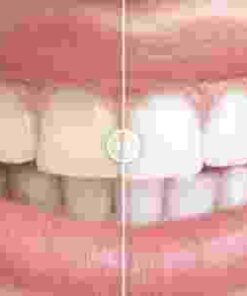 Before & After Images Comparison WordPress Plugin GPL