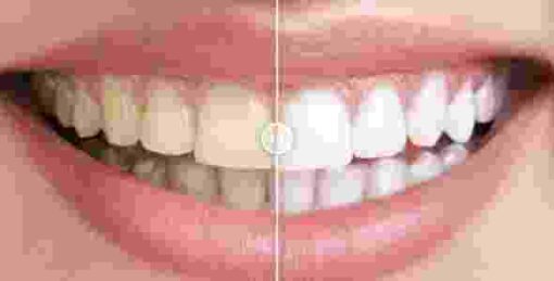 Before & After Images Comparison WordPress Plugin GPL